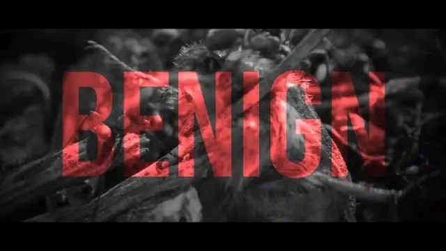 BENIGN ( Ft. DEVIN SHIDAKER OF THE ACACIA STRAIN)